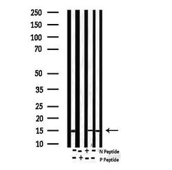 Invitrogen Phospho-Survivin (Thr117) Polyclonal Antibody 100 &mu;L | Buy Online | Invitrogen&trade; | Fisher Scientific