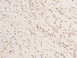 Invitrogen Phospho-PDPK1 (Ser241) Polyclonal Antibody 100 &mu;L; Unconjugated:Antibodies,