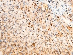 Invitrogen Phospho-PDPK1 (Ser241) Polyclonal Antibody 100 &mu;L; Unconjugated:Antibodies,