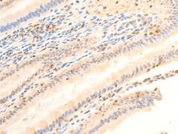 Invitrogen Phospho-PDPK1 (Ser241) Polyclonal Antibody 100 &mu;L; Unconjugated:Antibodies,