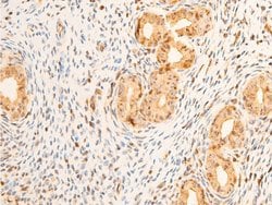 Invitrogen Phospho-PDPK1 (Ser241) Polyclonal Antibody 100 &mu;L; Unconjugated:Antibodies,