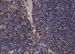 Invitrogen Phospho-JAK2 (Tyr221) Polyclonal Antibody 100 &mu;L; Unconjugated:Antibodies,