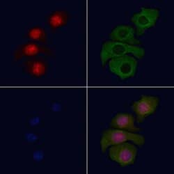 Invitrogen Phospho-MiTF (Ser180) Polyclonal Antibody 100 &mu;L; Unconjugated:Antibodies,