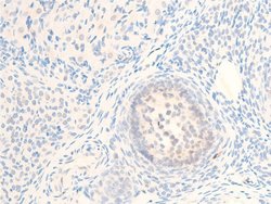 Invitrogen Phospho-MiTF (Ser180) Polyclonal Antibody 100 &mu;L; Unconjugated:Antibodies,