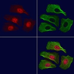 Invitrogen Phospho-MSK1 (Ser376) Polyclonal Antibody 100 &mu;L | Buy Online | Invitrogen&trade; | Fisher Scientific