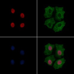 Invitrogen Phospho-SNAIL (Ser246) Polyclonal Antibody 100 &mu;L; Unconjugated:Antibodies,