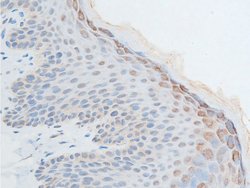 Invitrogen Phospho-Chk2 (Thr387) Polyclonal Antibody 100 &mu;L; Unconjugated:Antibodies,