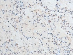 Invitrogen Phospho-Chk2 (Thr387) Polyclonal Antibody 100 &mu;L; Unconjugated:Antibodies,
