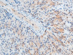 Invitrogen Phospho-Chk2 (Thr387) Polyclonal Antibody 100 &mu;L; Unconjugated:Antibodies,
