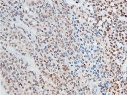 Invitrogen Phospho-Chk2 (Thr387) Polyclonal Antibody 100 &mu;L; Unconjugated:Antibodies,