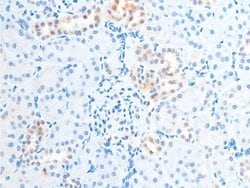 Invitrogen Phospho-Chk2 (Thr387) Polyclonal Antibody 100 &mu;L; Unconjugated:Antibodies,