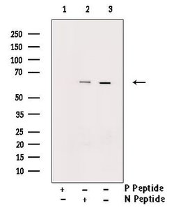 Invitrogen Phospho-Chk2 (Thr387) Polyclonal Antibody 100 &mu;L; Unconjugated:Antibodies,