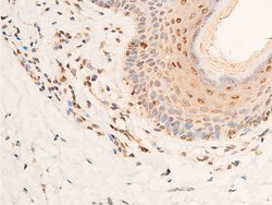 Invitrogen Phospho-Chk2 (Thr383) Polyclonal Antibody 100 &mu;L; Unconjugated:Antibodies,