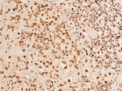 Invitrogen Phospho-Chk2 (Thr383) Polyclonal Antibody 100 &mu;L; Unconjugated:Antibodies,