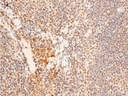 Invitrogen Phospho-Chk2 (Thr383) Polyclonal Antibody 100 &mu;L; Unconjugated:Antibodies,