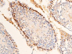 Invitrogen Phospho-Chk2 (Thr383) Polyclonal Antibody 100 &mu;L; Unconjugated:Antibodies,