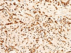 Invitrogen Phospho-Chk2 (Thr383) Polyclonal Antibody 100 &mu;L; Unconjugated:Antibodies,