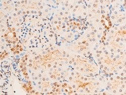 Invitrogen Phospho-Chk2 (Thr383) Polyclonal Antibody 100 &mu;L; Unconjugated:Antibodies,