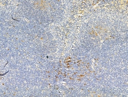 Invitrogen Phospho-Chk2 (Thr68) Polyclonal Antibody 100 &mu;L; Unconjugated:Antibodies,