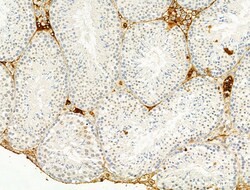 Invitrogen Phospho-Chk2 (Thr68) Polyclonal Antibody 100 &mu;L; Unconjugated:Antibodies,