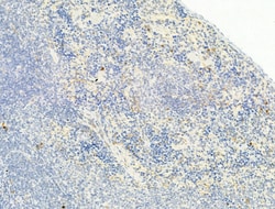 Invitrogen Phospho-Chk2 (Thr68) Polyclonal Antibody 100 &mu;L; Unconjugated:Antibodies,