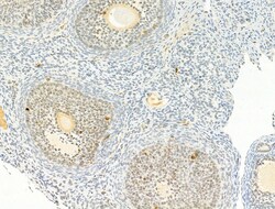 Invitrogen Phospho-Chk2 (Thr68) Polyclonal Antibody 100 &mu;L; Unconjugated:Antibodies,