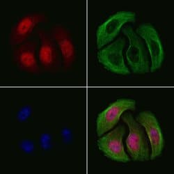 Invitrogen Phospho-Chk2 (Thr68) Polyclonal Antibody 100 &mu;L; Unconjugated:Antibodies,