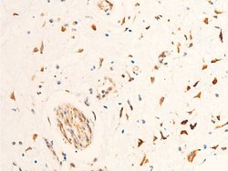 Invitrogen Phospho-Chk2 (Thr68) Polyclonal Antibody 100 &mu;L; Unconjugated:Antibodies,