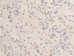 Invitrogen Phospho-Chk2 (Thr68) Polyclonal Antibody 100 &mu;L; Unconjugated:Antibodies,