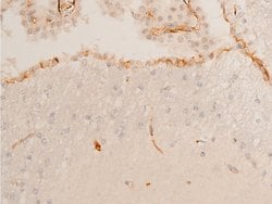 Invitrogen Phospho-Chk2 (Thr68) Polyclonal Antibody 100 &mu;L; Unconjugated:Antibodies,