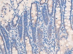 Invitrogen Phospho-Chk2 (Thr68) Polyclonal Antibody 100 &mu;L; Unconjugated:Antibodies,
