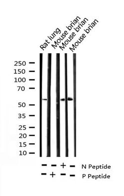 Invitrogen Phospho-Chk2 (Thr68) Polyclonal Antibody 100 &mu;L; Unconjugated:Antibodies,