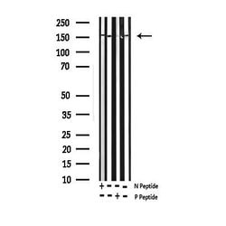 Invitrogen Phospho-EGFR (Thr693) Polyclonal Antibody 100 &mu;L; Unconjugated:Antibodies,