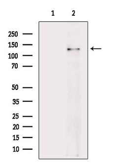 Invitrogen Phospho-EGFR (Tyr1016) Polyclonal Antibody 100 &mu;L; Unconjugated:Antibodies,