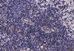 Invitrogen Phospho-EGFR (Ser1070) Polyclonal Antibody 100 &mu;L; Unconjugated:Antibodies,