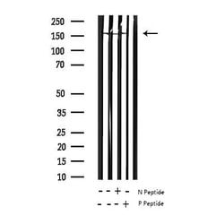 Invitrogen Phospho-EGFR (Ser1070) Polyclonal Antibody 100 &mu;L; Unconjugated:Antibodies,
