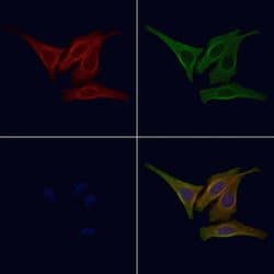 Invitrogen Phospho-EGFR (Tyr1092) Polyclonal Antibody 100 &mu;L; Unconjugated:Antibodies,