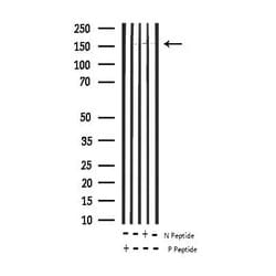 Invitrogen Phospho-EGFR (Tyr1092) Polyclonal Antibody 100 &mu;L; Unconjugated:Antibodies,