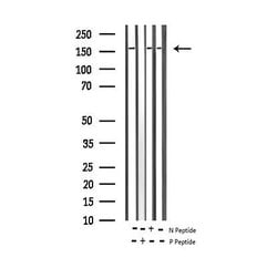 Invitrogen Phospho-EGFR (Tyr1110) Polyclonal Antibody 100 &mu;L | Buy Online | Invitrogen&trade; | Fisher Scientific
