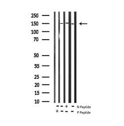 Invitrogen Phospho-EGFR (Tyr1172) Polyclonal Antibody 100 &mu;L; Unconjugated:Antibodies,