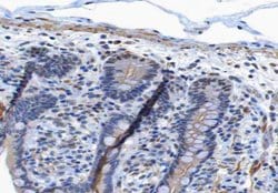 Invitrogen Phospho-EGFR (Tyr1197) Polyclonal Antibody 100 &mu;L; Unconjugated:Antibodies,