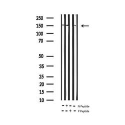Invitrogen Phospho-EGFR (Tyr1197) Polyclonal Antibody 100 &mu;L; Unconjugated:Antibodies,
