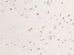 Invitrogen Phospho-EGFR (Ser695) Polyclonal Antibody 100 &mu;L; Unconjugated:Antibodies,