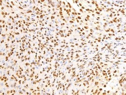 Invitrogen Phospho-EGFR (Ser695) Polyclonal Antibody 100 &mu;L; Unconjugated:Antibodies,