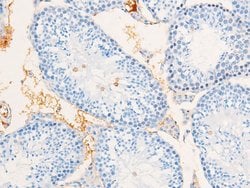 Invitrogen Phospho-EGFR (Ser695) Polyclonal Antibody 100 &mu;L; Unconjugated:Antibodies,