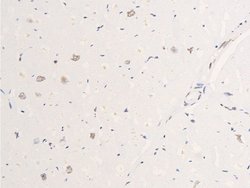 Invitrogen Phospho-EGFR (Ser695) Polyclonal Antibody 100 &mu;L; Unconjugated:Antibodies,