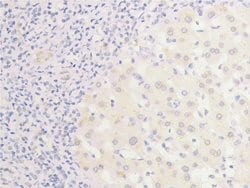 Invitrogen Phospho-EGFR (Ser1026) Polyclonal Antibody 100 &mu;L; Unconjugated:Antibodies,
