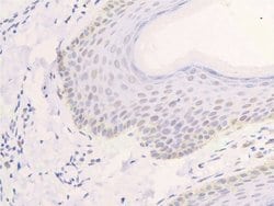 Invitrogen Phospho-EGFR (Ser1026) Polyclonal Antibody 100 &mu;L; Unconjugated:Antibodies,