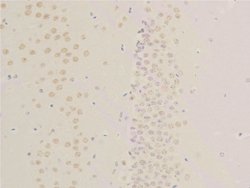 Invitrogen Phospho-EGFR (Ser1026) Polyclonal Antibody 100 &mu;L; Unconjugated:Antibodies,