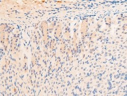 Invitrogen Phospho-EGFR (Ser1026) Polyclonal Antibody 100 &mu;L; Unconjugated:Antibodies,